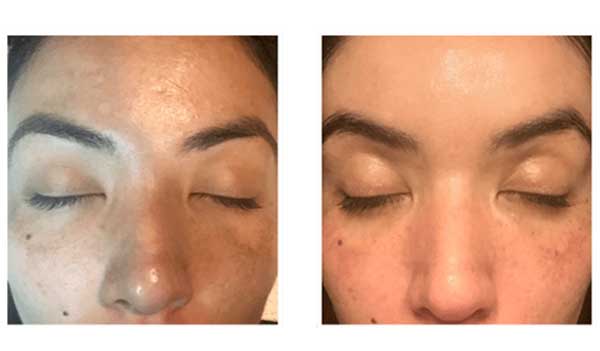 derma skincare center
